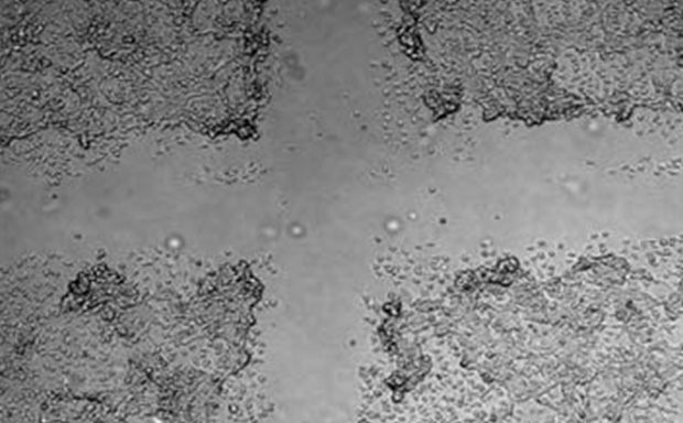 The Cell Comb scratch assay measures cell migration Grayscale, highlighting the differences in cell density and morphology.