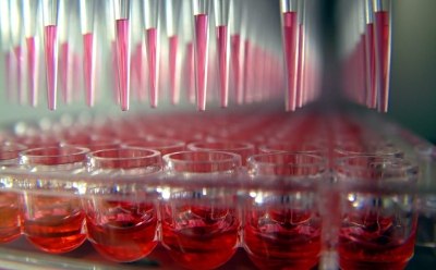 Criblage de génomique fonctionnelle Criblage de génomique fonctionnelle