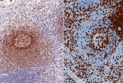 Immunohistochemistry Immunohistochemistry