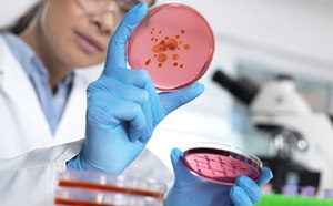 Microbial bioburden and water testing Lab worker inspecting culture disk