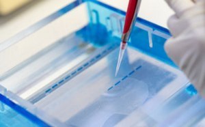 Agarose gel electrophoresis Nucleic acid samples with blue dye being pipetted into a gel for electrophoresis